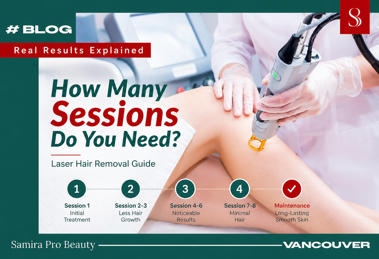 How Many Sessions Do You Need for Laser Hair Removal? (Real Results Explained)