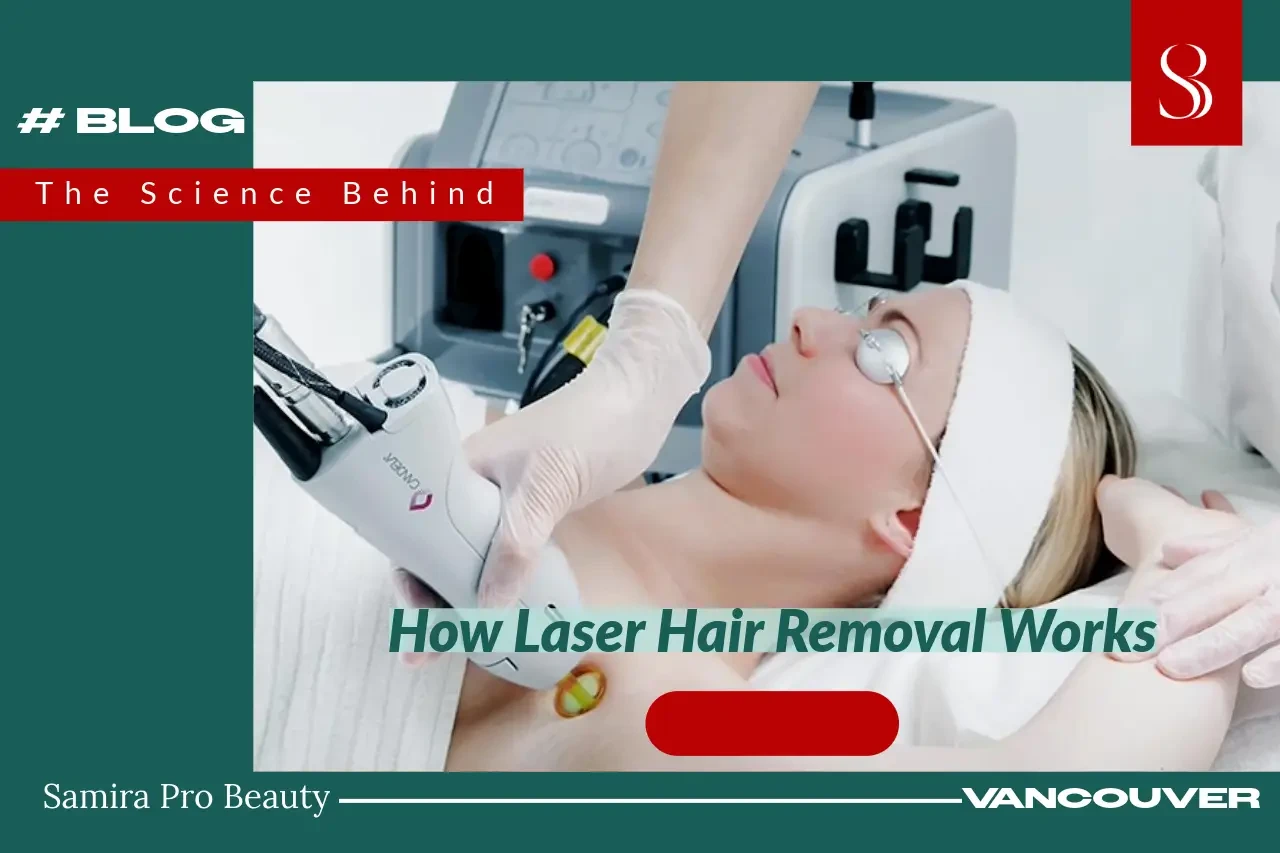 The Science Behind Laser Hair Removal