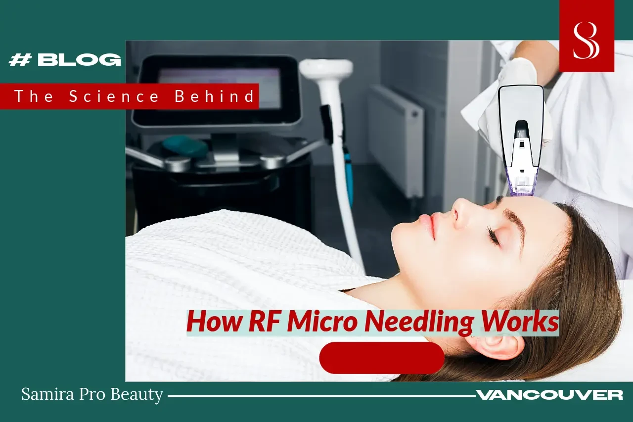 Why Morpheus8 Is Skin’s New Best Friend