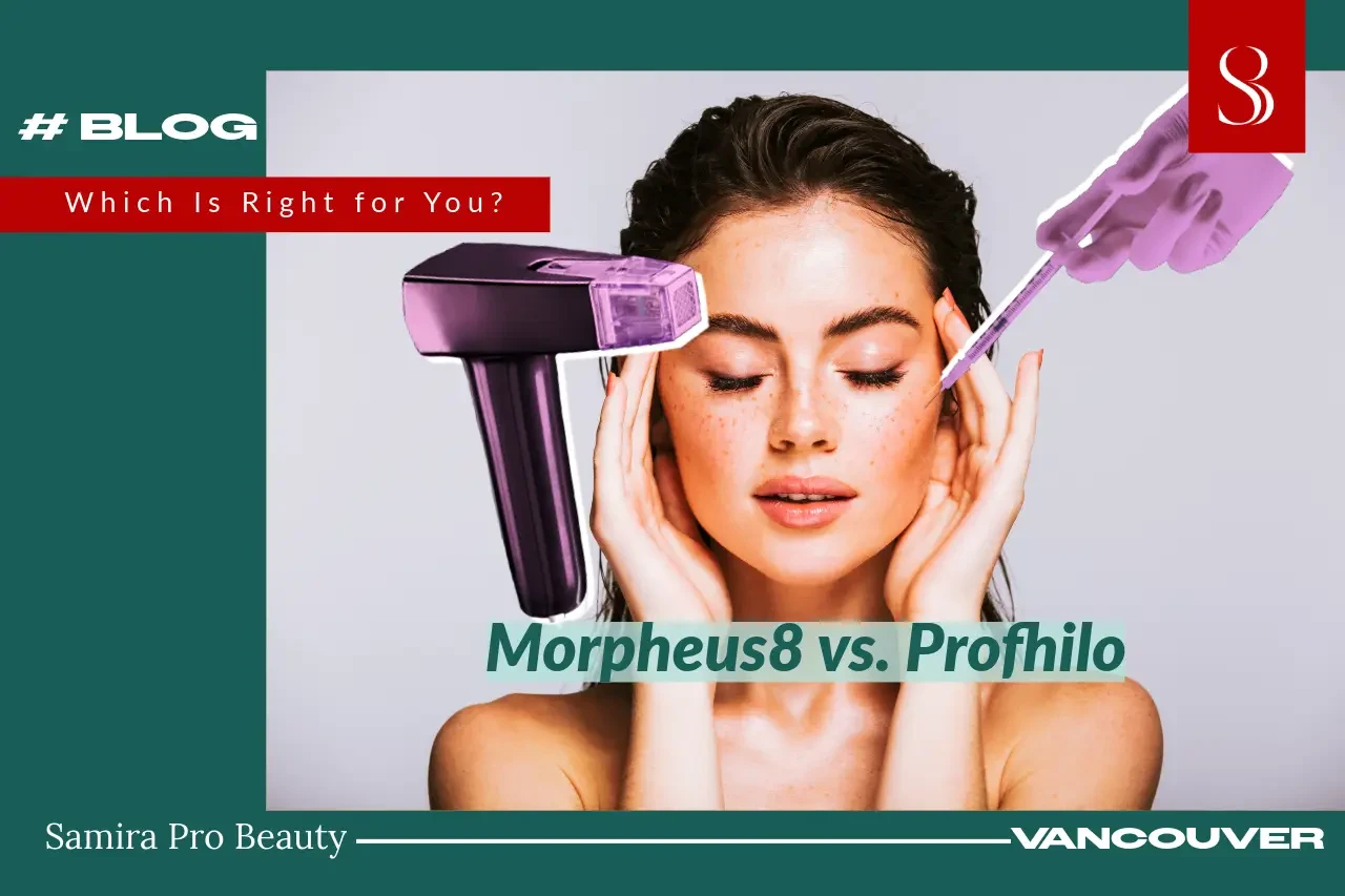 Morpheus8 or Profhilo